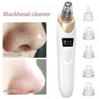 Blackhead Vacuum Remover – Electric Pore Cleanser